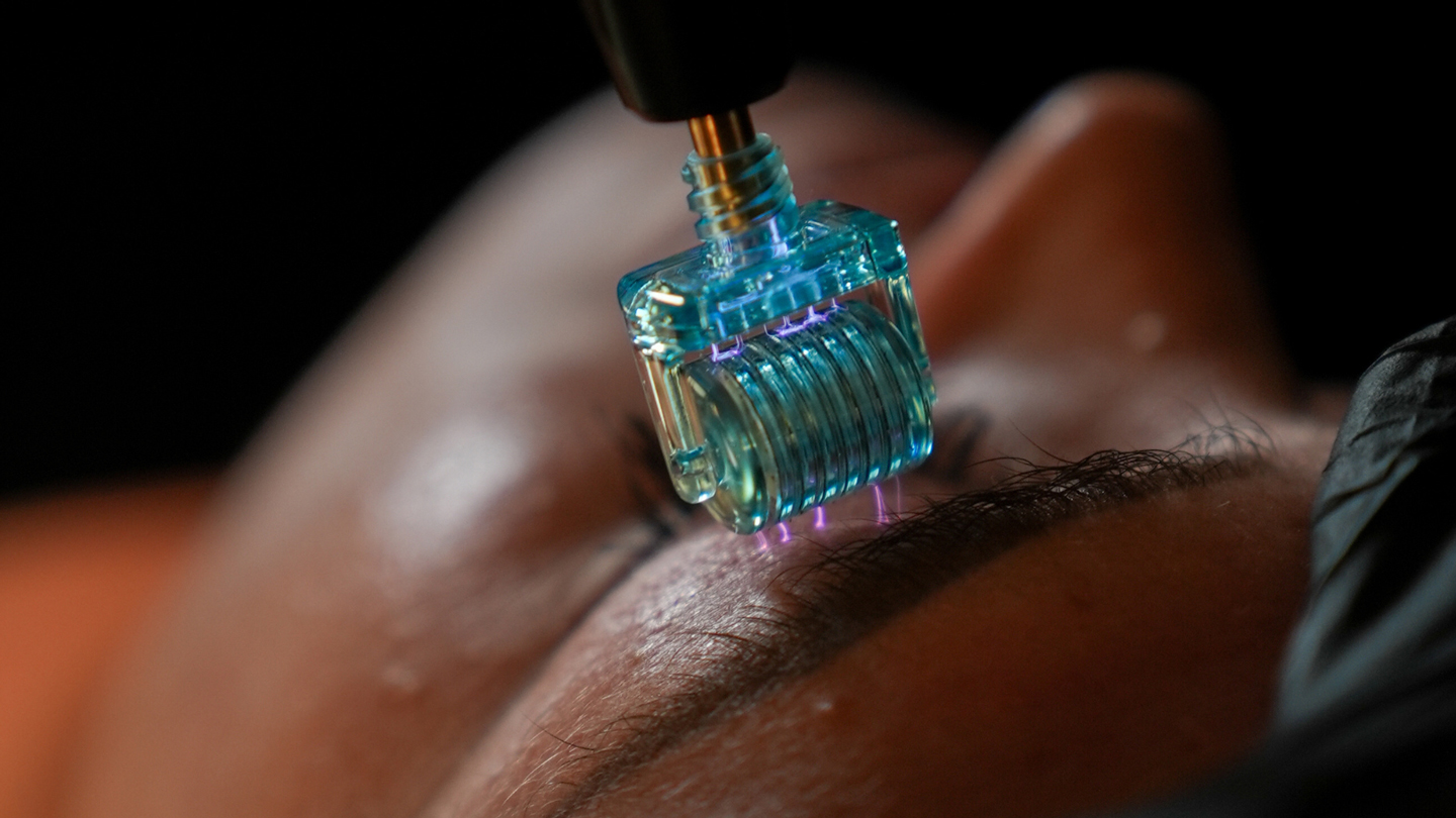 Scar Revision thumbnail image