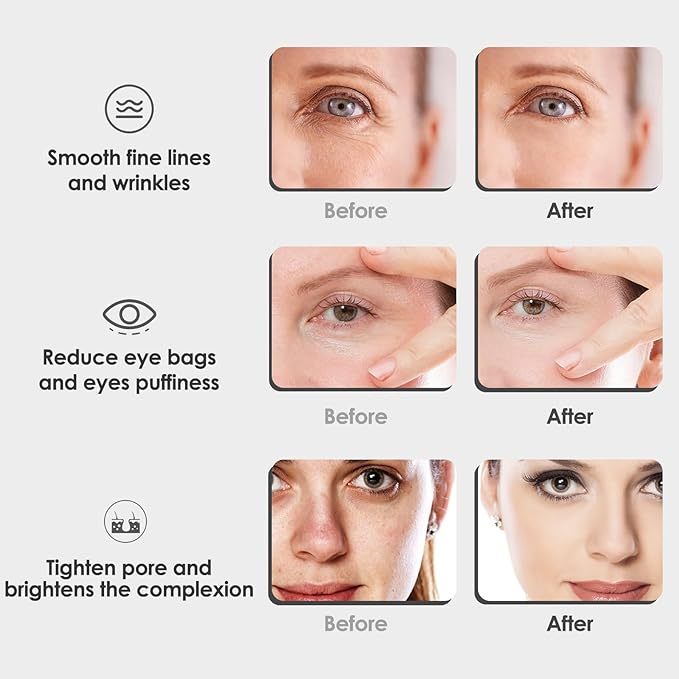 Facial Ice Globe gallery image