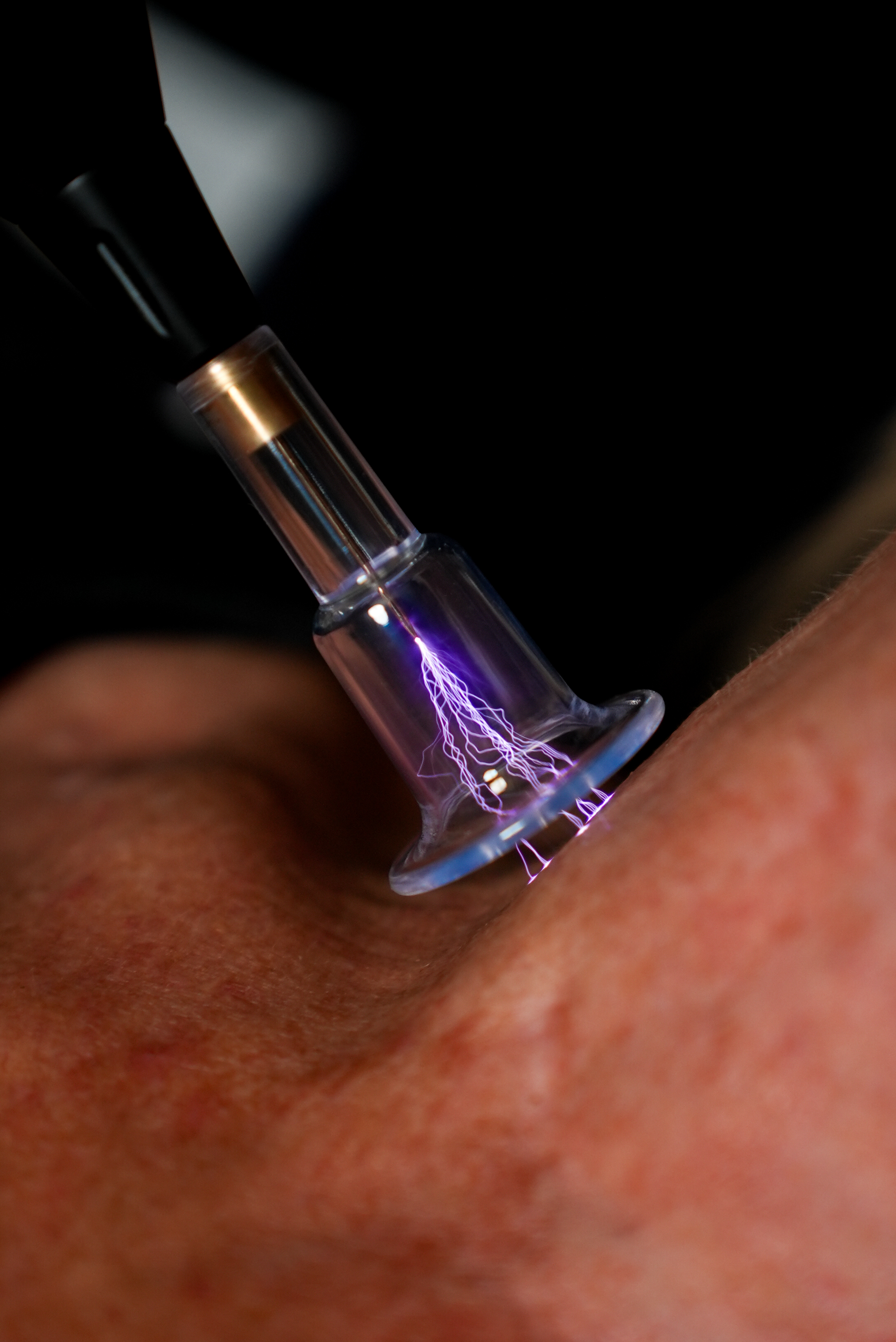 Fusion Complete box Probes gallery image