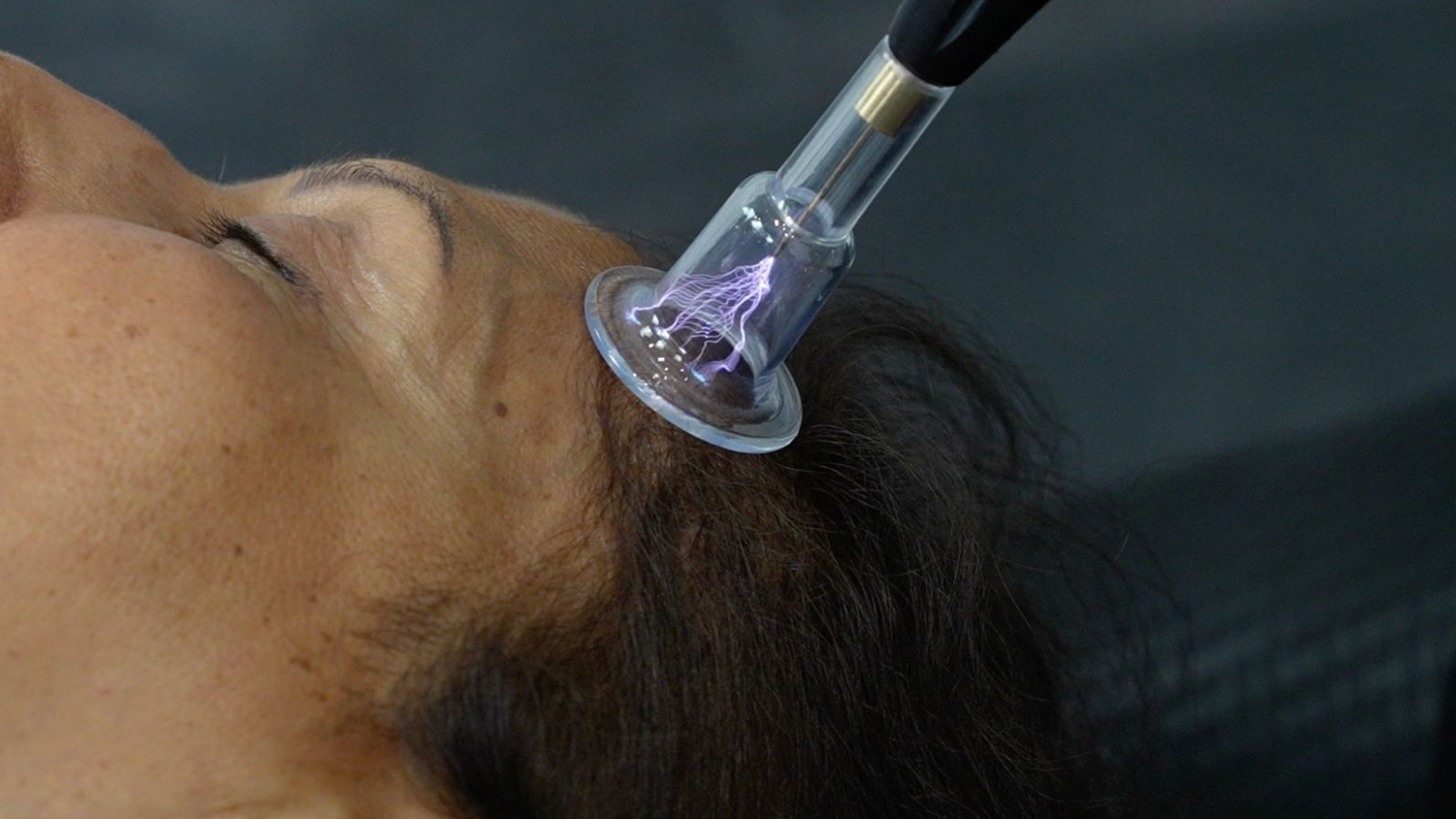 Hair Restoration thumbnail image