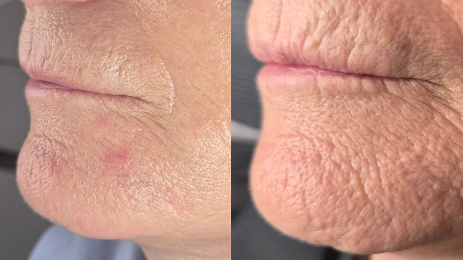 Fusion Facial Live Webinar thumbnail image