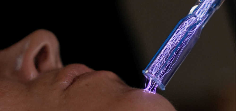 What is Plasma Fibroblast Therapy?