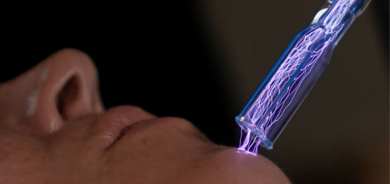 What is Plasma Fibroblast Therapy?